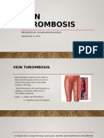 Vein Thrombosis