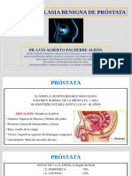 H.B.P (Hiperplasia Benigna de Próstata: Dr. Luis Alberto Pacherre Albán