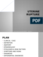 Uterine Rupture