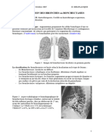 La Dilatation Des Bronches Ou Bonchectasies