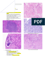 20 Neoplasms of The Kidney