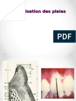 La Cicatrisation Des Plaies Examen