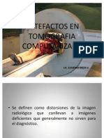 Artefactos en Tomografia