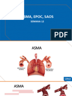 Semana 12 - Asma, Epoc, Soas