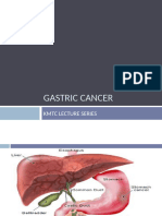 Gastric Cancer