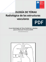 Radioloía de Las Estructuras Vasculares