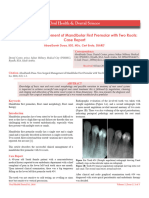 Nonsurgical Management of Mandibular First Premolar With Two Roots Case Report