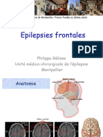 EEG Épilepsies Frontales 2024