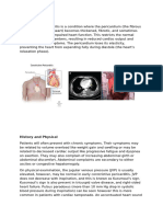 Constrictive Pericarditis