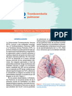 Tromboembolia Pulmonar