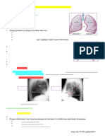 6 Anatomie Lobaire Et Segmentaire Du Poumon N.M