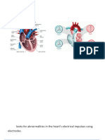 Cardiac Disease