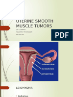 Uterine Smooth Muscle Tumors