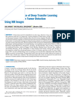 On The Performance of Deep Transfer Learning Networks For Brain Tumor Detection Using MR Images