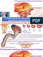 Reduce El Tamaño de Tú Próstata Evita La Hipertrofia Prostática