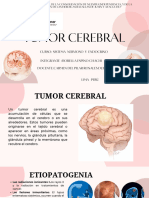 Tumor Cerebral