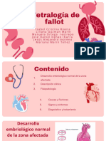 Tetralogia de Fallot