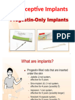 5 Implants