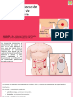 Técnica de Colocación de Bolsa de Colostomía