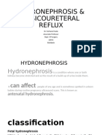 Hydronephrosis