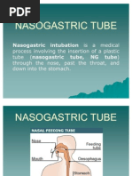 Nasogastric Tube