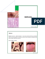 neoplasia