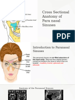 Cross-Sectional-Anatomy-of-Para-nasal-Sinuses PRESENTATION