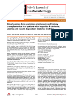 Simultaneous liver, pancreas-duodenum and kidney transplantation in a patient with hepatitis B cirrhosis, uremia and insulin dependent diabetes mellitus