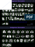 Imagenes Radiologicas Normales