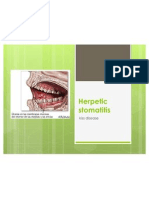 Herpetic Stomatitis - Power Point