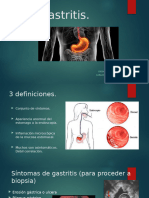 Gastritis