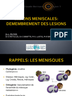 DIU SPORT   LESIONS MENISCALES_DR PELTIER (1)