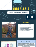 Acondroplasia