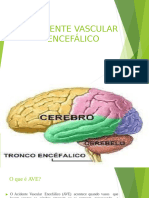 Acidente Vascular Encefálico Aula 4