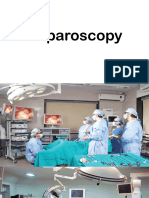 Laparoscopy