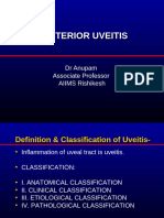 Posterior Uveitis