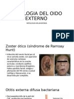 OTITITS EXTERNA