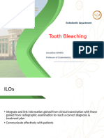 Tooth Bleaching