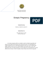 Ectopic Pregnancy