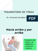 Trauma de Tórax