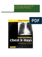 Interpreting Chest X Rays Illustrated with 100 Cases 1st Edition Philip Eng all chapter instant download