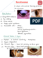 3. Keratoconus