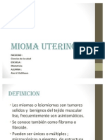 Mioma Uterino