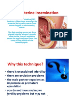 Artificial Insemination