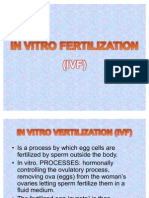 In Vitro Fertilization