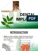 Dental Implants