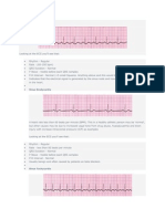 Normal Sinus Rhythm