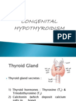 Congenital Hypothyroidism