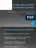 Fibroma Osificante Central en Maxilar Superior