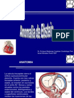 Anomalia de Ebstein